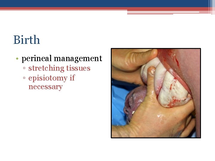 Birth • perineal management ▫ stretching tissues ▫ episiotomy if necessary 