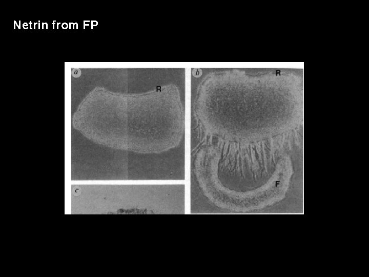 Netrin from FP 