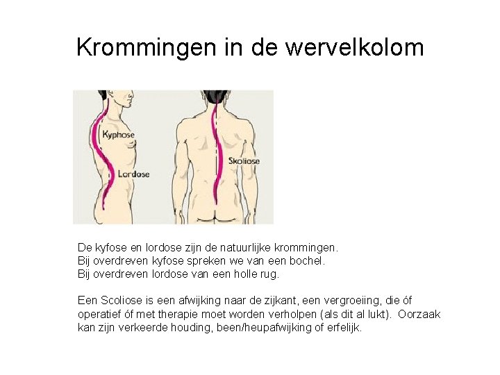 Krommingen in de wervelkolom De kyfose en lordose zijn de natuurlijke krommingen. Bij overdreven