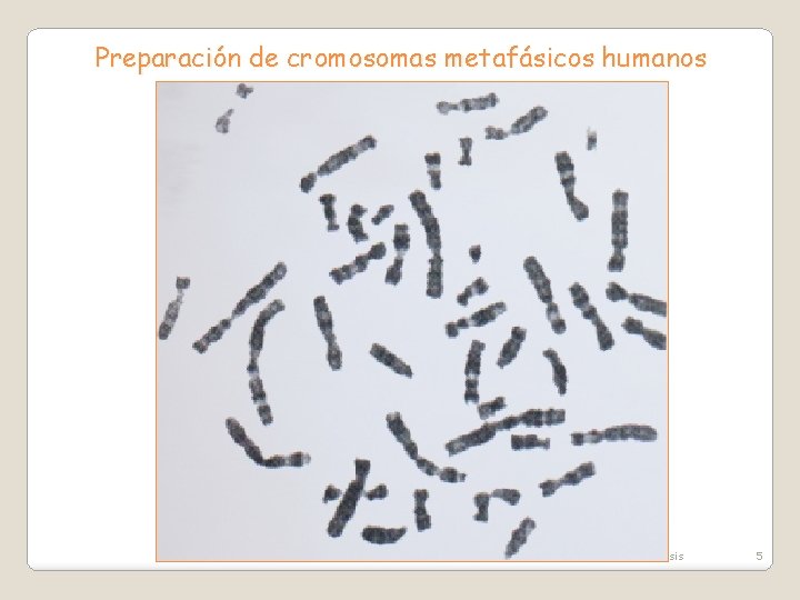 Preparación de cromosomas metafásicos humanos Tema 2: Mitosis y meiosis 5 