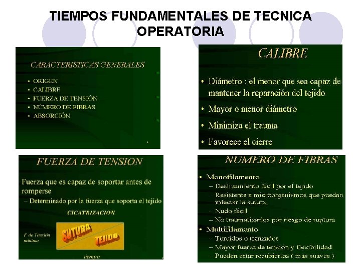 TIEMPOS FUNDAMENTALES DE TECNICA OPERATORIA 