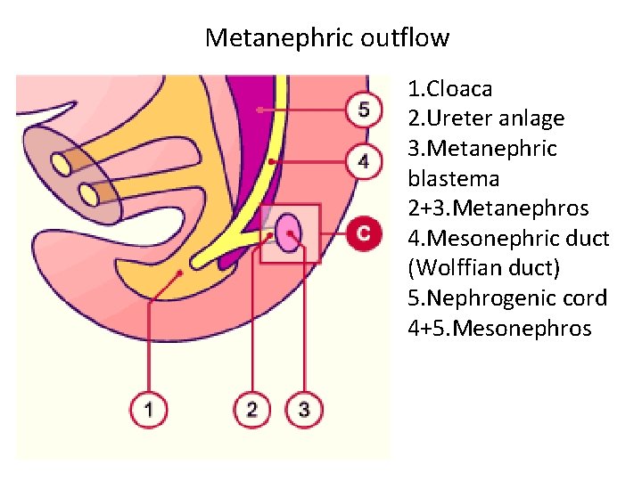 Metanephric outflow 1. Cloaca 2. Ureter anlage 3. Metanephric blastema 2+3. Metanephros 4. Mesonephric