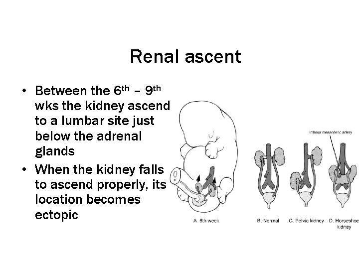 Renal ascent • Between the 6 th – 9 th wks the kidney ascend