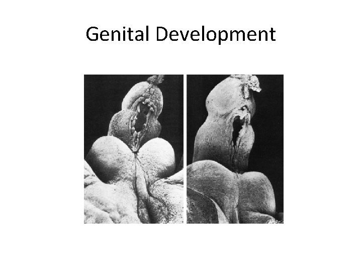 Genital Development 