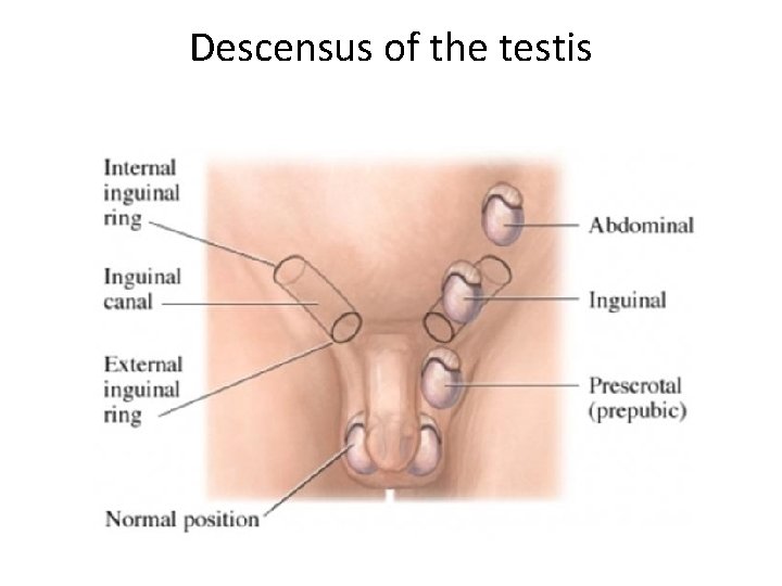 Descensus of the testis 