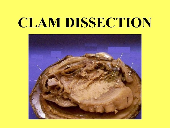CLAM DISSECTION 