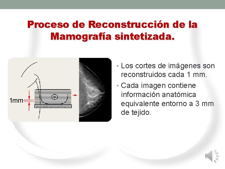 Proceso de Reconstrucción de la Mamografía sintetizada. • Los cortes de imágenes son reconstruidos