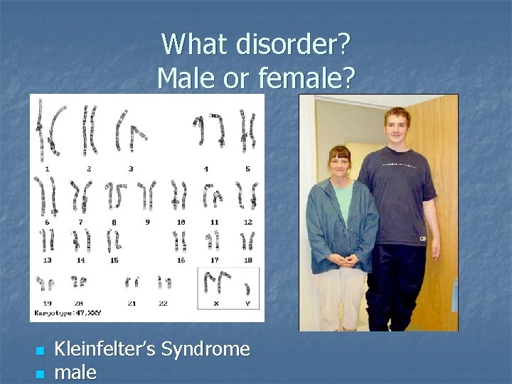 What disorder? Male or female? n n Kleinfelter’s Syndrome male 
