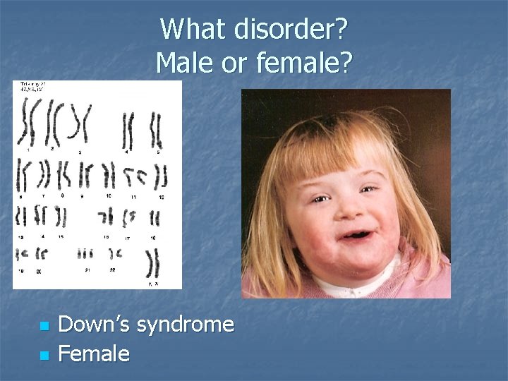 What disorder? Male or female? n n Down’s syndrome Female 