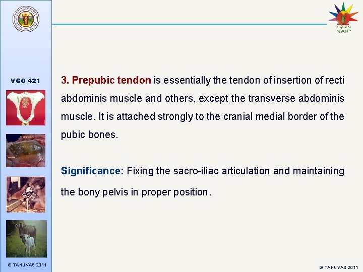 VGO 421 3. Prepubic tendon is essentially the tendon of insertion of recti abdominis