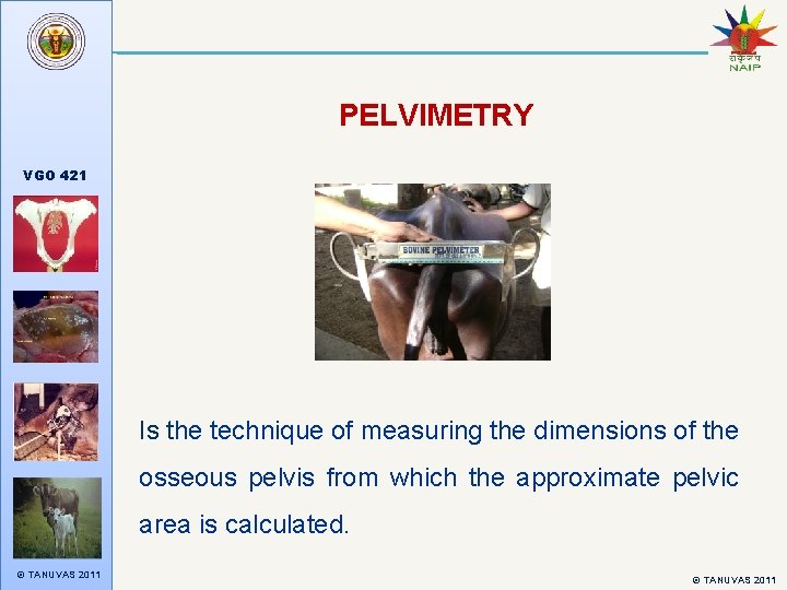 PELVIMETRY VGO 421 Is the technique of measuring the dimensions of the osseous pelvis