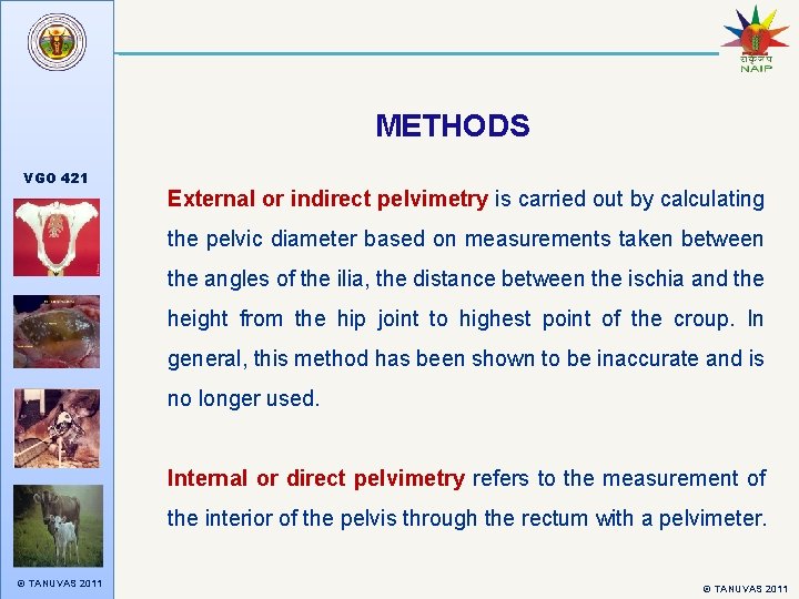 METHODS VGO 421 External or indirect pelvimetry is carried out by calculating the pelvic