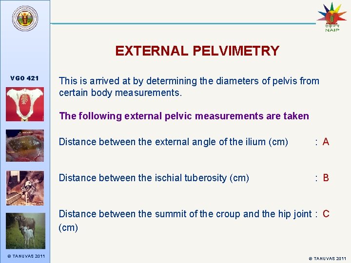 EXTERNAL PELVIMETRY VGO 421 This is arrived at by determining the diameters of pelvis