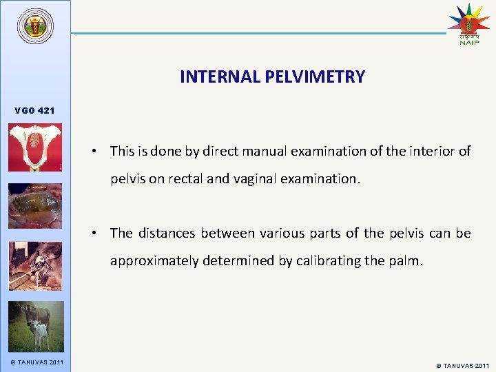 INTERNAL PELVIMETRY VGO 421 • This is done by direct manual examination of the