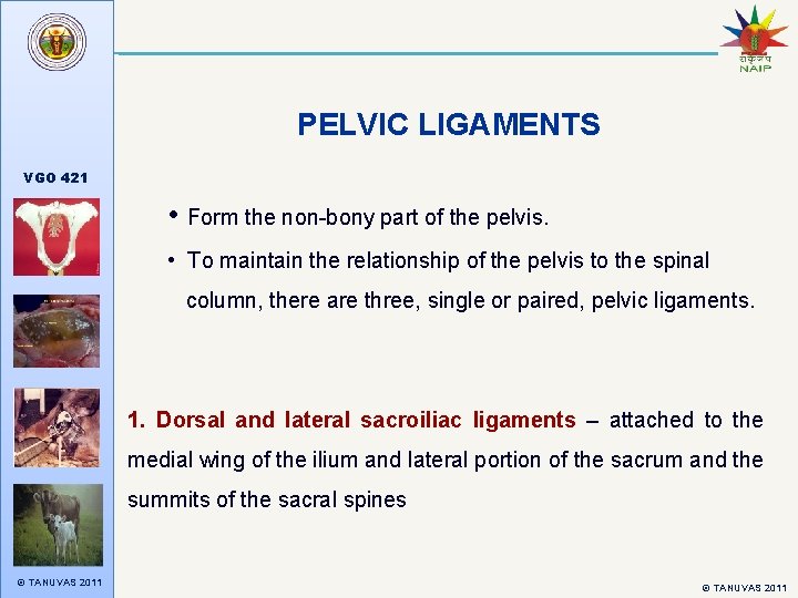 PELVIC LIGAMENTS VGO 421 • Form the non-bony part of the pelvis. • To
