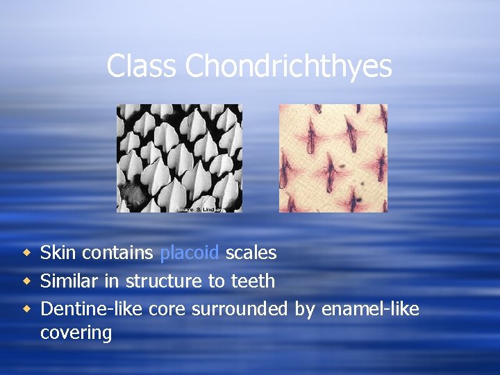 Class Chondrichthyes w Skin contains placoid scales w Similar in structure to teeth w