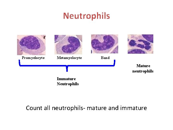 Neutrophils Promyelocyte Metamyelocyte Band Mature neutrophils Immature Neutrophils Count all neutrophils- mature and immature