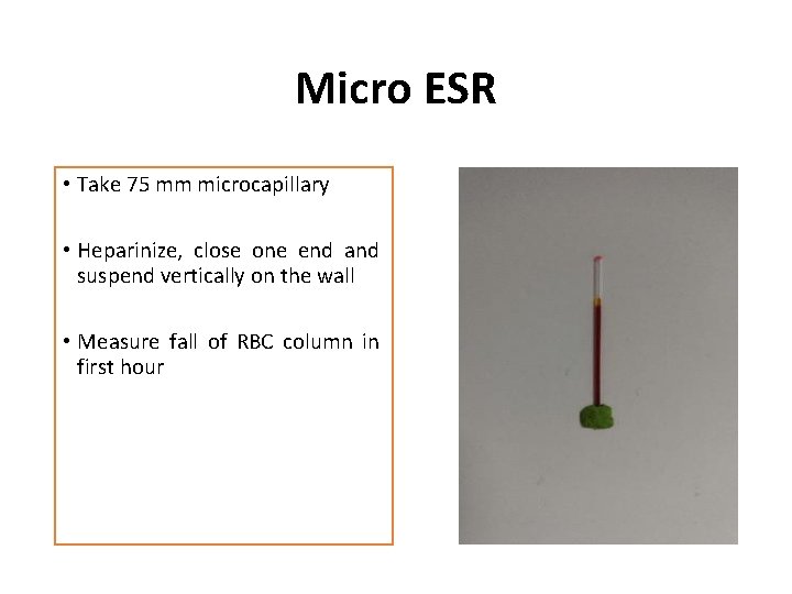Micro ESR • Take 75 mm microcapillary • Heparinize, close one end and suspend