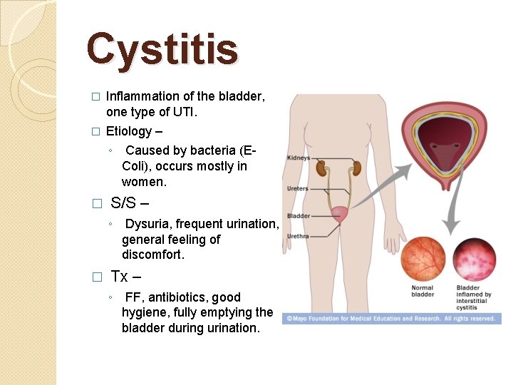 Cystitis � Inflammation of the bladder, one type of UTI. � Etiology – ◦