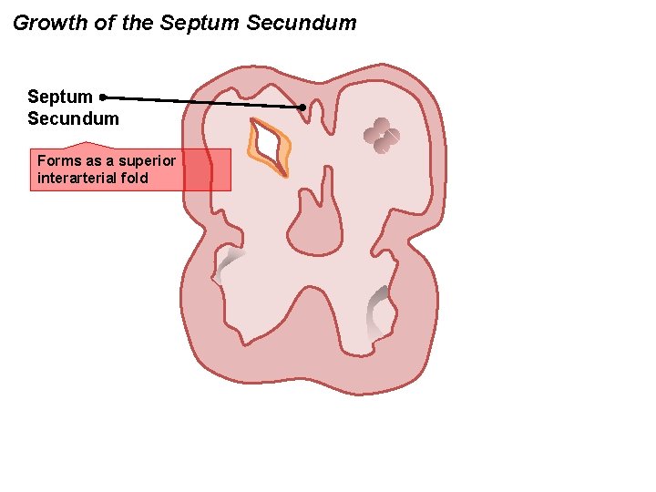 Growth of the Septum Secundum Forms as a superior interarterial fold 