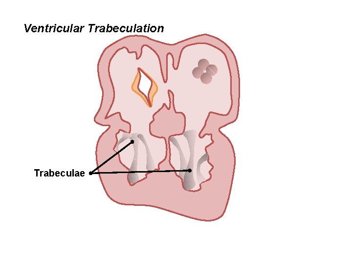 Ventricular Trabeculation Trabeculae 