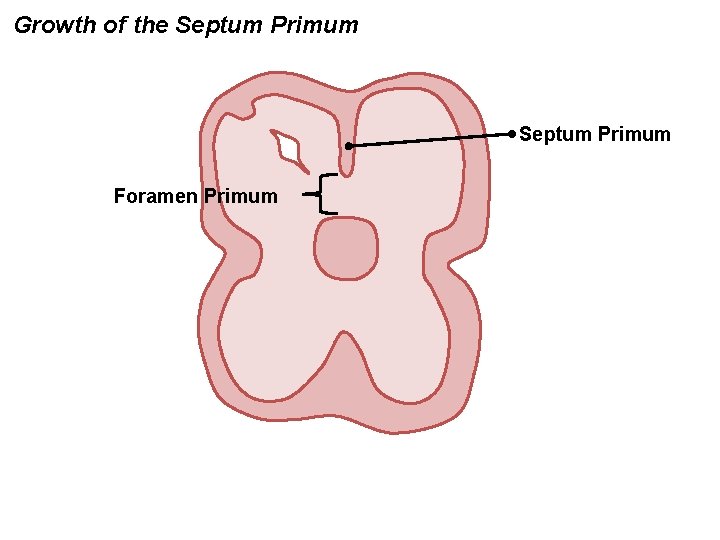 Growth of the Septum Primum Foramen Primum 