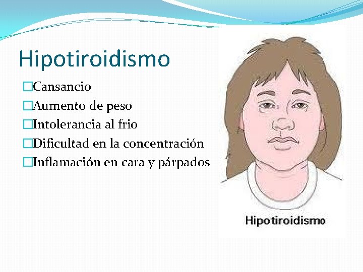 Hipotiroidismo �Cansancio �Aumento de peso �Intolerancia al frio �Dificultad en la concentración �Inflamación en