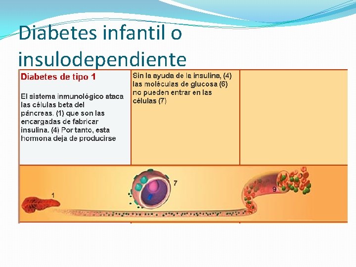 Diabetes infantil o insulodependiente 