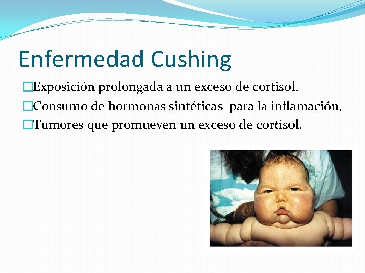 Enfermedad Cushing �Exposición prolongada a un exceso de cortisol. �Consumo de hormonas sintéticas para