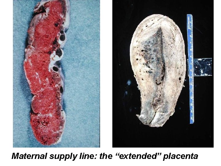 Maternal supply line: the “extended” placenta 