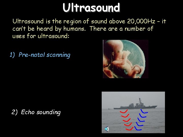 Ultrasound is the region of sound above 20, 000 Hz – it can’t be
