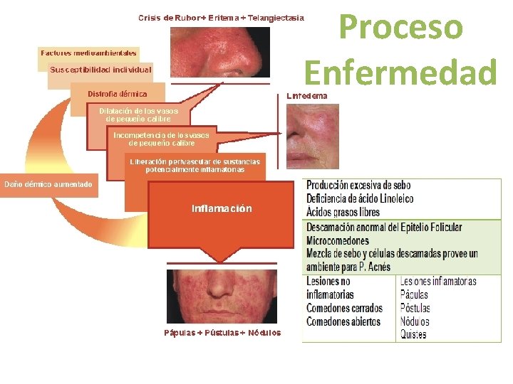 Proceso Enfermedad 