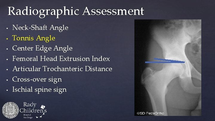Radiographic Assessment • • Neck-Shaft Angle Tonnis Angle Center Edge Angle Femoral Head Extrusion