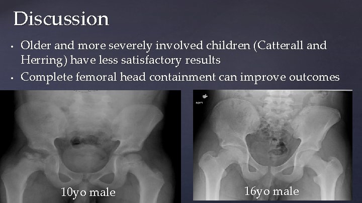 Discussion • • Older and more severely involved children (Catterall and Herring) have less