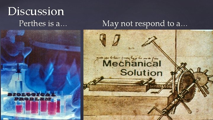 Discussion Perthes is a… May not respond to a… 