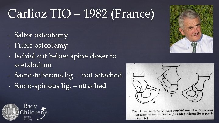 Carlioz TIO – 1982 (France) • • • Salter osteotomy Pubic osteotomy Ischial cut