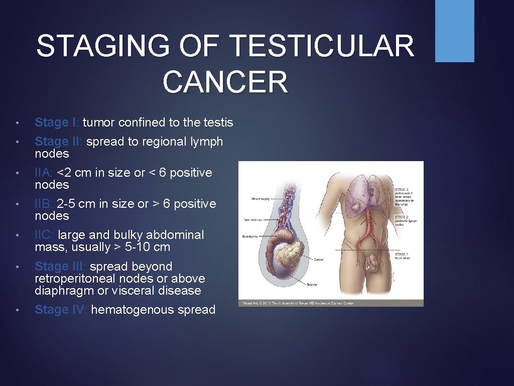 STAGING OF TESTICULAR CANCER • Stage I: tumor confined to the testis • Stage