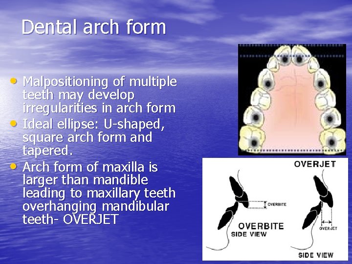 Dental arch form • Malpositioning of multiple • • teeth may develop irregularities in