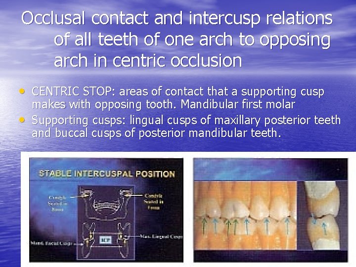 Occlusal contact and intercusp relations of all teeth of one arch to opposing arch