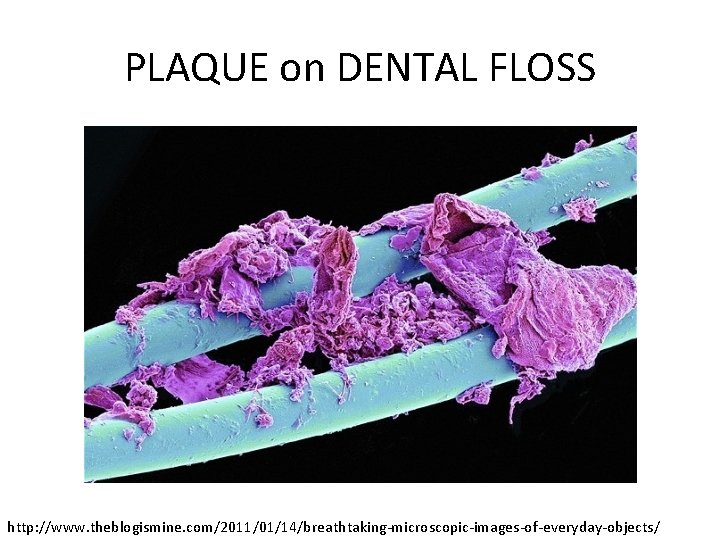 PLAQUE on DENTAL FLOSS http: //www. theblogismine. com/2011/01/14/breathtaking-microscopic-images-of-everyday-objects/ 