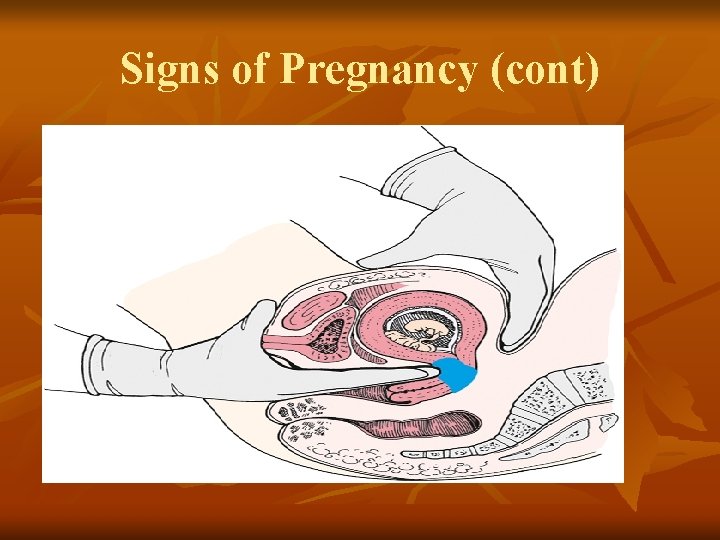 Signs of Pregnancy (cont) 