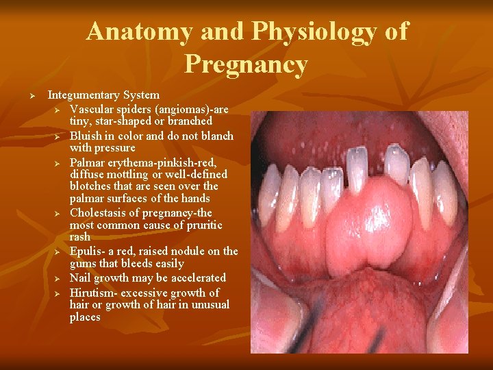 Anatomy and Physiology of Pregnancy Ø Integumentary System Ø Vascular spiders (angiomas)-are tiny, star-shaped