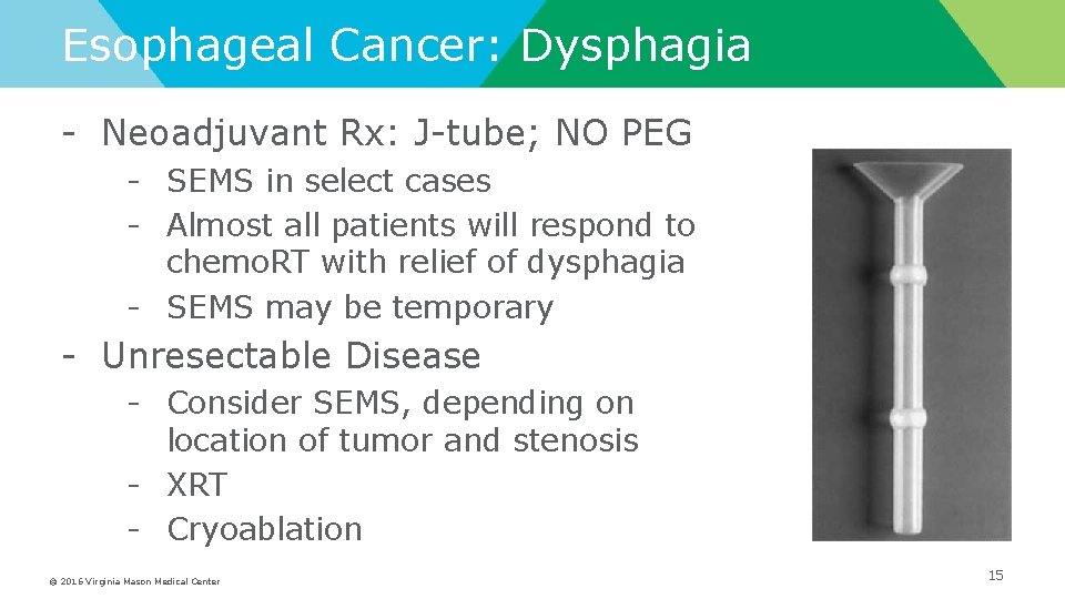 Esophageal Cancer: Dysphagia - Neoadjuvant Rx: J-tube; NO PEG - SEMS in select cases
