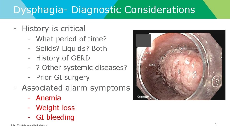 Dysphagia- Diagnostic Considerations - History is critical - What period of time? Solids? Liquids?