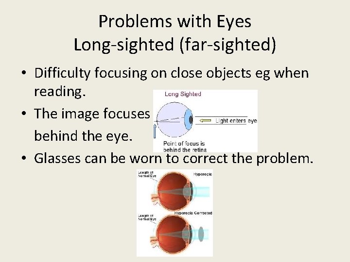 Problems with Eyes Long-sighted (far-sighted) • Difficulty focusing on close objects eg when reading.