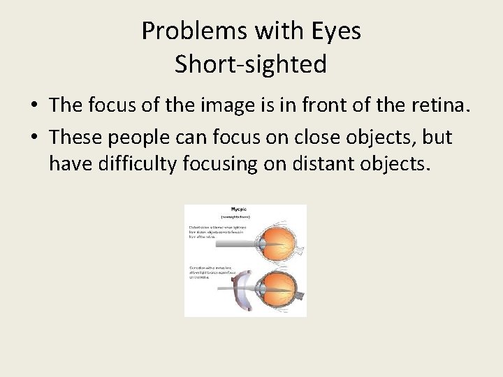 Problems with Eyes Short-sighted • The focus of the image is in front of