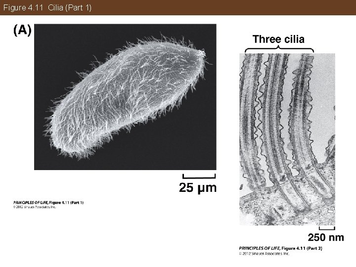 Figure 4. 11 Cilia (Part 1) 