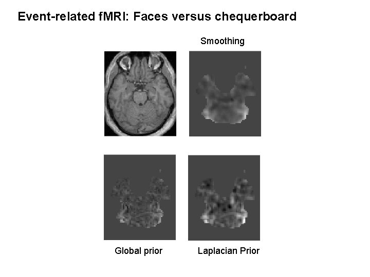 Event-related f. MRI: Faces versus chequerboard Smoothing Global prior Laplacian Prior 