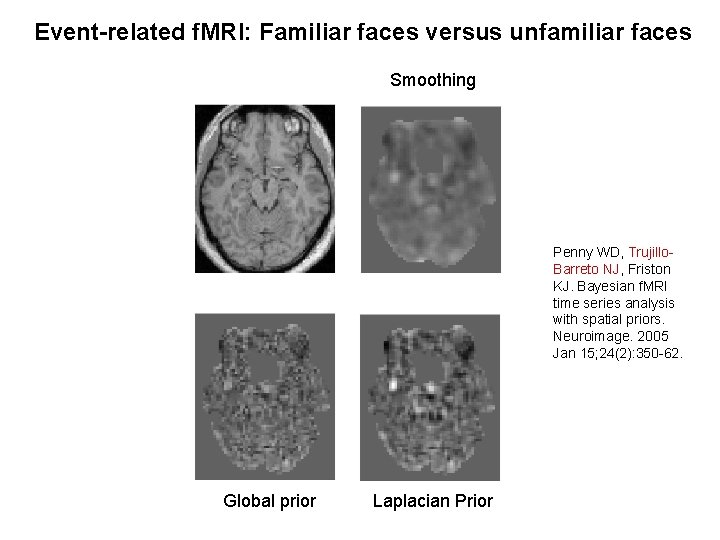Event-related f. MRI: Familiar faces versus unfamiliar faces Smoothing Penny WD, Trujillo. Barreto NJ,