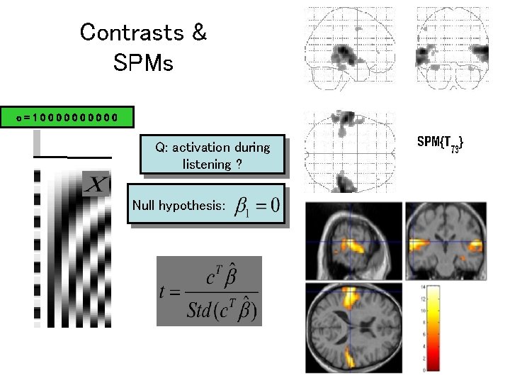 Contrasts & SPMs c=100000 Q: activation during listening ? Null hypothesis: 
